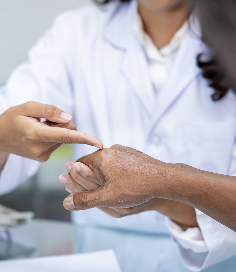 Allergy treatment at Live Well Wellness Center